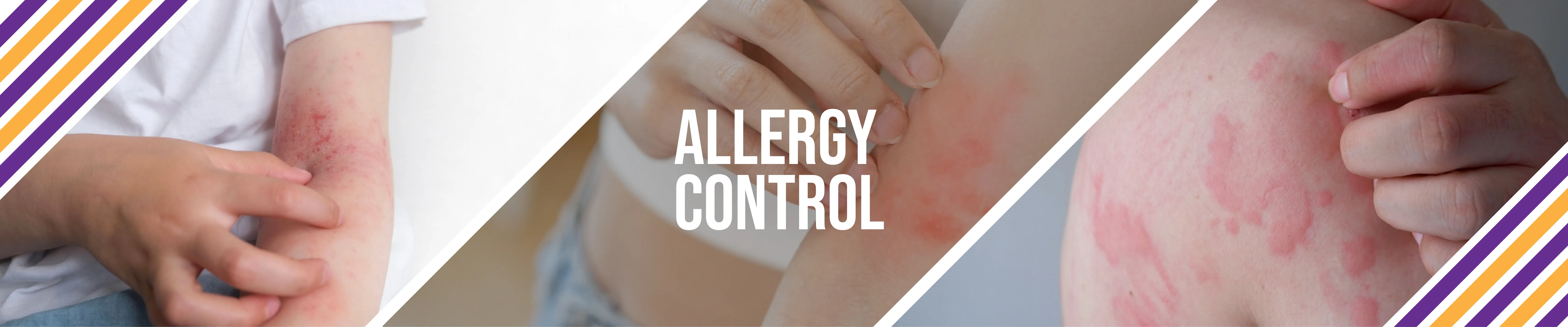 carpet cleaning, carpet cleaners, cleaning services, cleaning services in si, cleaning services in staten island, carpet cleaning in si, carpet cleaning in staten island, carpet cleaning si, carpet cleaners in si, carpet cleaners in staten island, carpet cleaning services, si carpet cleaning, si carpet cleaners, staten island carpet cleaning, staten island carpet cleaners, staten island carpet cleaning services, rug cleaning, rug cleaners, si rug cleaning, si rug cleaners, rug cleaning in si, rug cleaners in si, commercial carpet cleaning, commercial carpet cleaning in si, si commercial carpet cleaning, upholstery cleaning, upholstery cleaning si, upholstery cleaners in si, si upholstery cleaning, si upholstery cleaners, bed bug treatment, bed bug treatment si, si bed bug treatment, stain removal, stain removal si