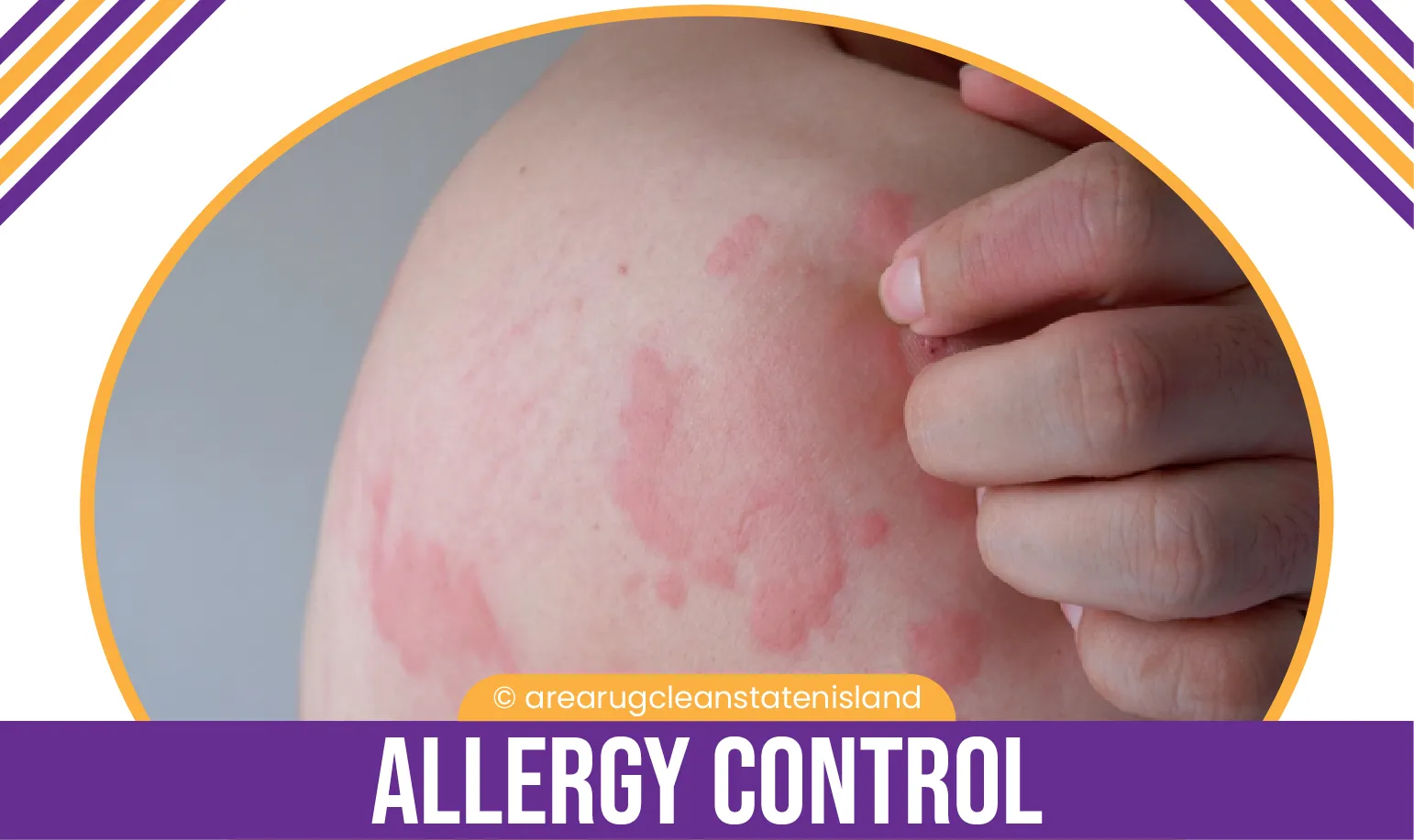 carpet cleaning, carpet cleaners, cleaning services, cleaning services in si, cleaning services in staten island, carpet cleaning in si, carpet cleaning in staten island, carpet cleaning si, carpet cleaners in si, carpet cleaners in staten island, carpet cleaning services, si carpet cleaning, si carpet cleaners, staten island carpet cleaning, staten island carpet cleaners, staten island carpet cleaning services, rug cleaning, rug cleaners, si rug cleaning, si rug cleaners, rug cleaning in si, rug cleaners in si, commercial carpet cleaning, commercial carpet cleaning in si, si commercial carpet cleaning, upholstery cleaning, upholstery cleaning si, upholstery cleaners in si, si upholstery cleaning, si upholstery cleaners, bed bug treatment, bed bug treatment si, si bed bug treatment, stain removal, stain removal si